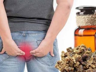 Hemorroide behandling med propolis